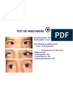 Test de Hirschberg