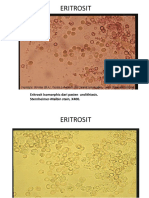 ERITROSIT ISOMORPHIC