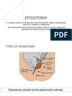 Episiotomy