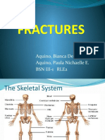 Fractures: Aquino, Bianca Denisse C. Aquino, Paula Nichaelle E. BSN Iii-1 Rle2