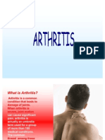 Arthritis