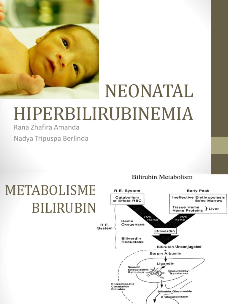 Neonatal Hiperbilirubinemia | PDF