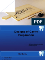 Cavity Preparation Designs