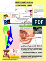 Tugas 1 Nurrohmah Maylingga 1910104144 E1 Poster Teknologi Reproduksi Bantuan Fertilisasi Dengan Bayi Tabung