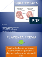 Placenta Previa Expo