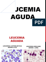 Leucemia Aguda