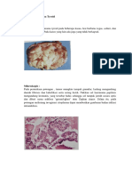 Jelaskan Gambaran Makroskopis Dan Mikroskopis Papillary Carcinoma Tyroid