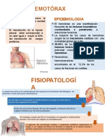 HEMOTORAX