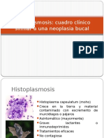 Histoplasmosis Expo