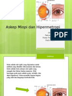Miopia Hipermetro