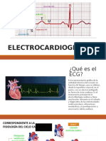 ECG: qué es y cómo funciona el electrocardiograma