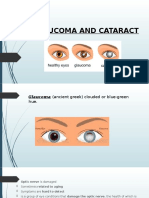 Glaucoma and Cataract