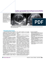 Diagnóstico prenatal HP