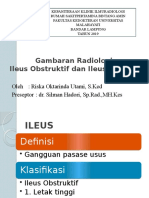 Gambaran Radiologi Ileus Obstruktif Dan Ileus Paralitik (Tugas)