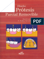 Diseño de Prótesis Parcial Removible PDF