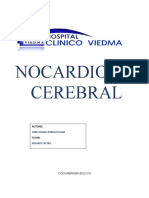 Caso Clinico Nocardia