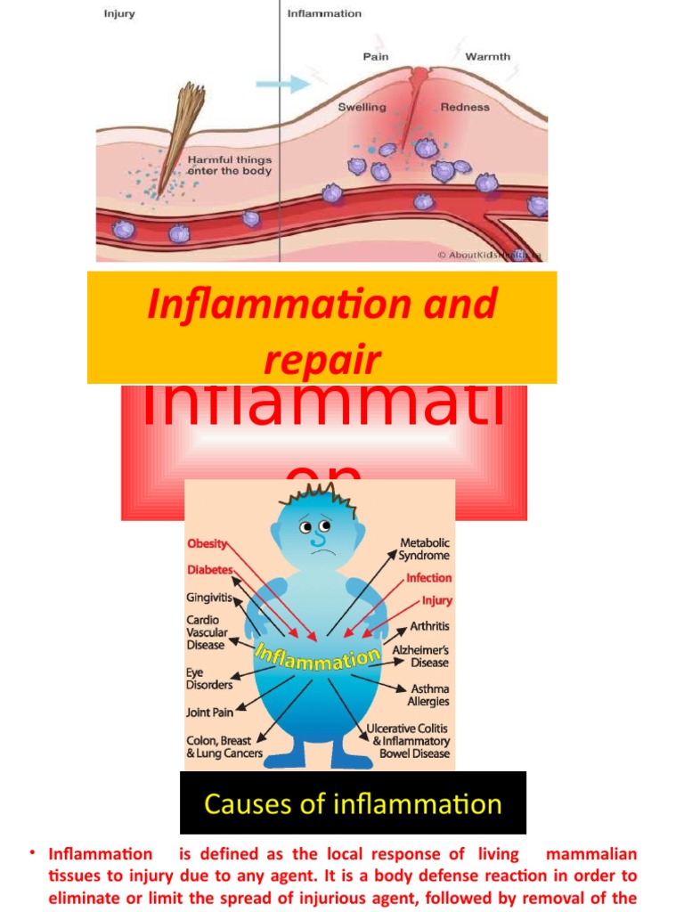 Basic Mechanism Involved in Process of Inflammation and Repair | PDF ...