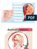 Trabajo Auriculoterapia