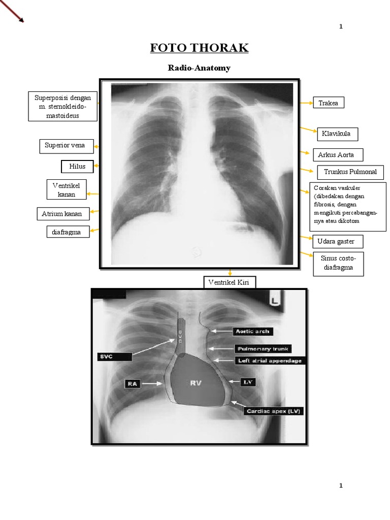 Ringkasan Radiologi | PDF