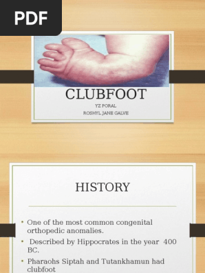 Clubfoot Pdf Diseases And Disorders Musculoskeletal System