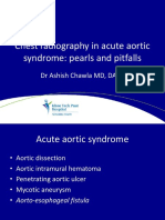 Acute Aortic Syndrome Ashish Chawla AOCR 2016 China