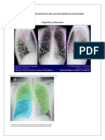 Componentes Imágenes Pulmonares1