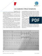 Cardiac Tamponade A Rare Complication of Nissen Fundoplication
