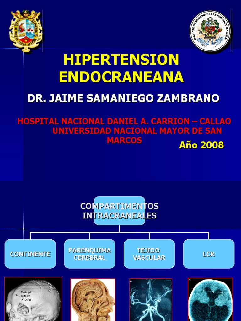Hipertensin Intracraneal Wikipedia La Enciclopedia Libre