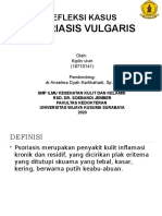 Psoriasis Vulgaris