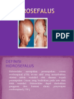 Penyuluhan Ppt-Hidrosefalus