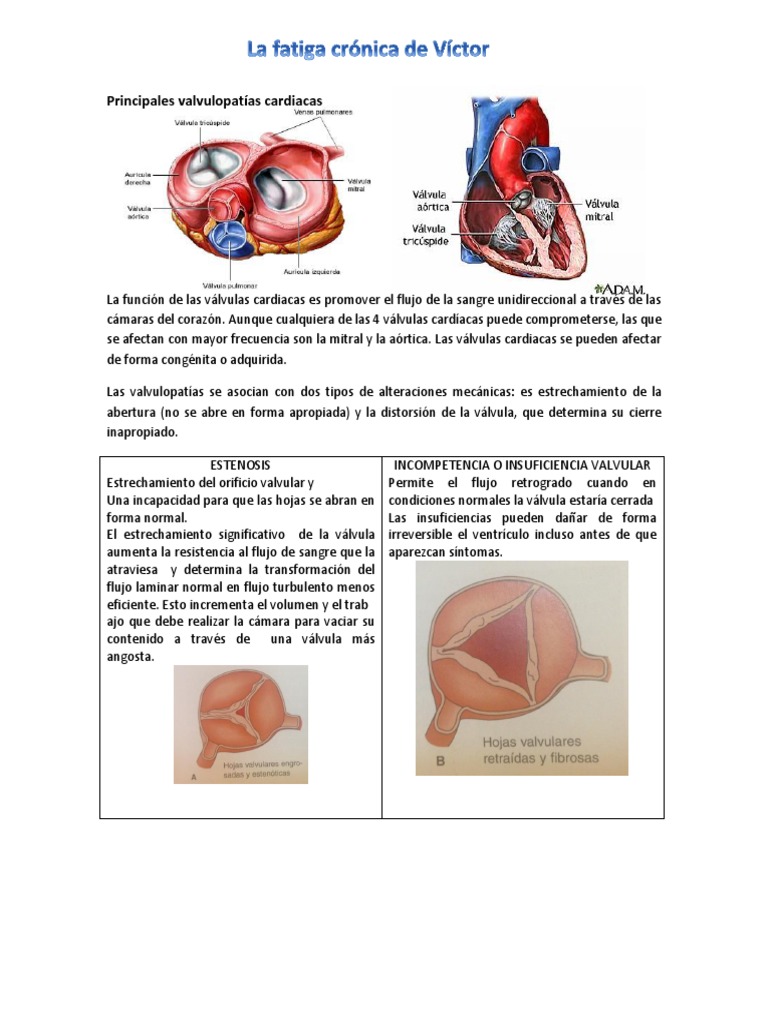 Prostatitis CIFR ICB