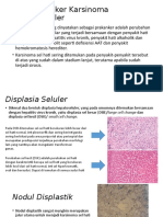 Patologi Anatomi Lesi Prakanker Karsinoma Hepatoseluler