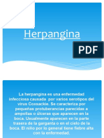 Herpangina