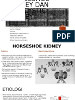 Horseshoe Kidney Dan Policystic Kidney SGD 6