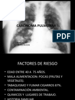 Carcinoma Pulmonar