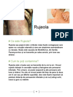 Rujeola