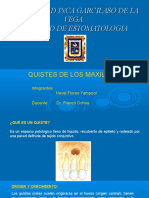 Quiste de Los Maxilares PDF