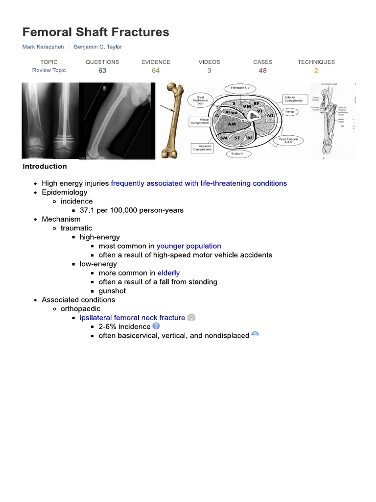 Femoral Shaft Fractures - Trauma - Orthobullets | PDF