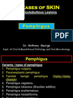 Vesiculobullous Lesions: Pemphigus Vulgaris