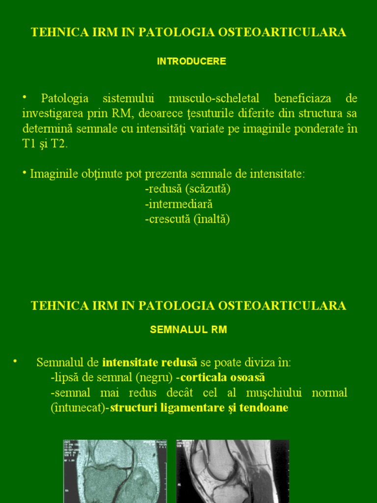 Curs RM Os Tehnica | PDF