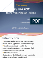 Intraventricular Lesions by Endos