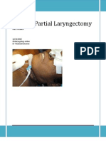 Vertical Partial Laryngectomy An Atlas