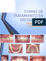 Etapas de Tratamiento en Ortodoncia