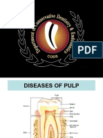 Diseases of Pulp