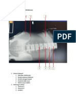 Hasil Evaluasi Abdomen Proyeksi LLD