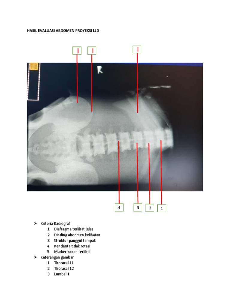 Hasil Evaluasi Abdomen Proyeksi LLD | PDF