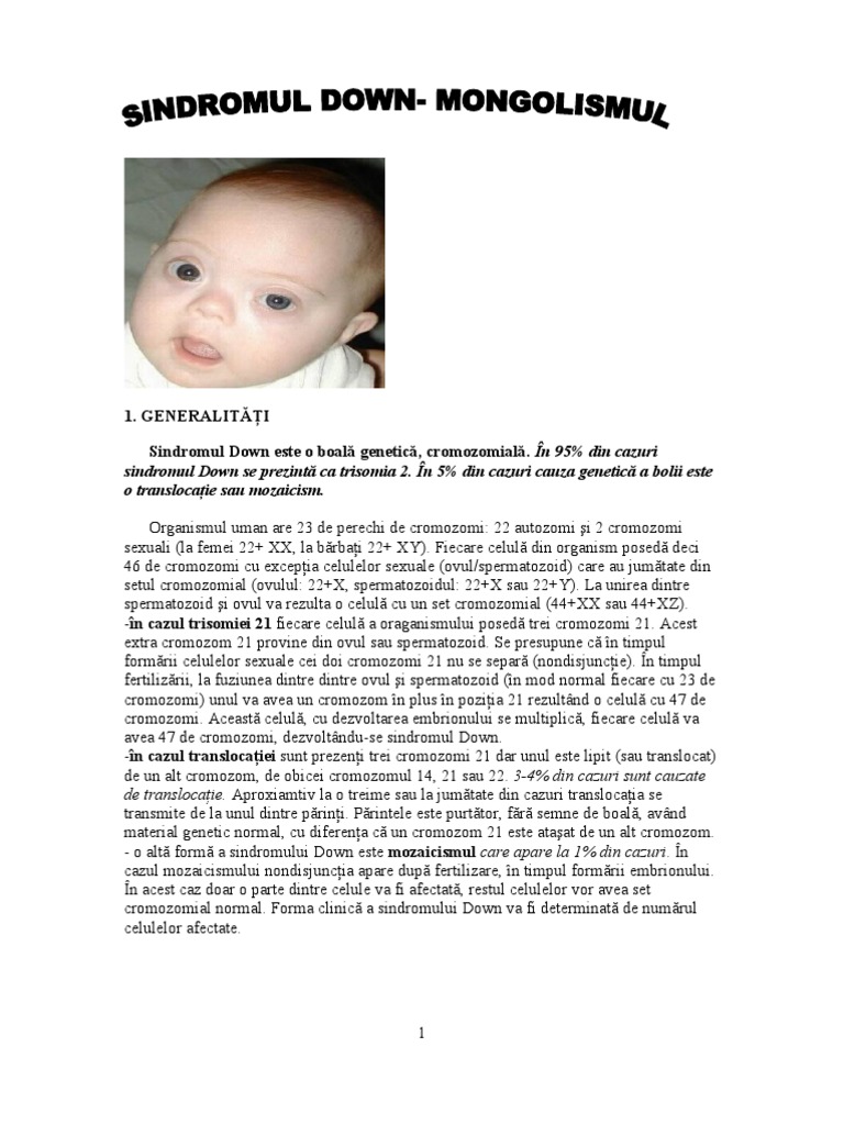 Реферат: Down Syndrome Essay Research Paper Down SyndromePeople