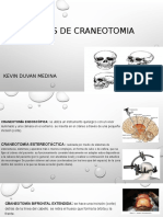 Clases de Craneotomia