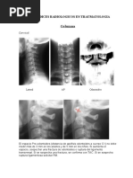 Análisis del Ángulo Lumbosacro y Ferguson | PDF | La columna vertebral ...