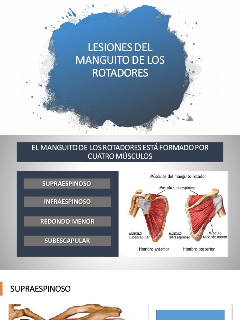 Lesiones del Manguito Rotador | PDF | Hombro | Ciencia de la danza
